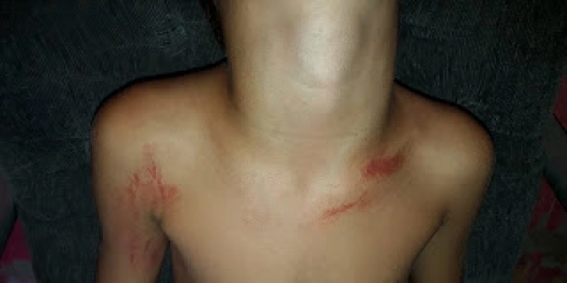 NESTA SEXTA: Criança é espancada por colega dentro de escola; Leia 