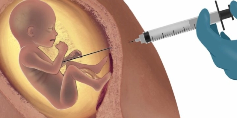 Aborto - Vida ou Morte - Em 2010, 55% das mulheres realizaram o procedimento
