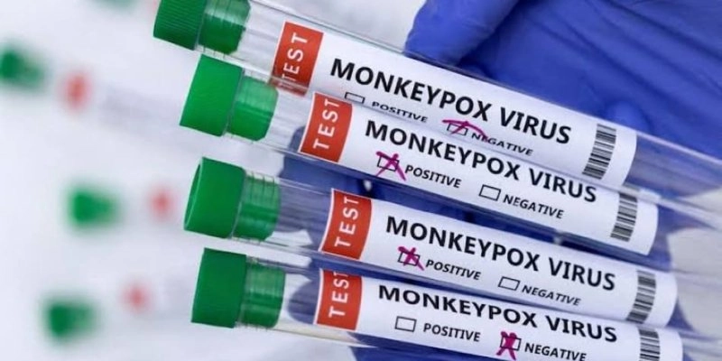 Mpox: conheça sintomas e tire principais dúvidas sobre a doença
