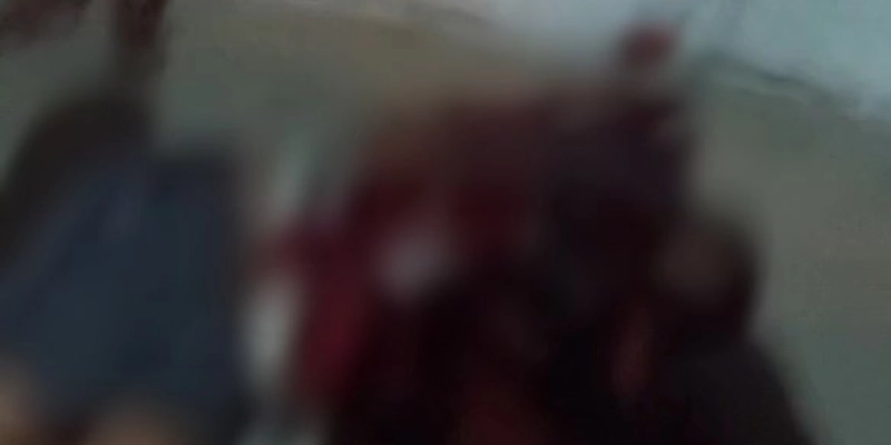 Homem é baleado em atentado a bala na cidade de Sousa
