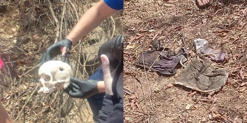 Ossada com crânio perfurado levanta suspeitas de homicídio em zona rural de São João do Rio do Peixe
