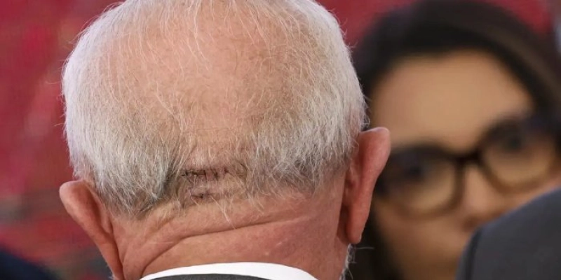  Lula faz exames em Brasília e apresenta quadro estável