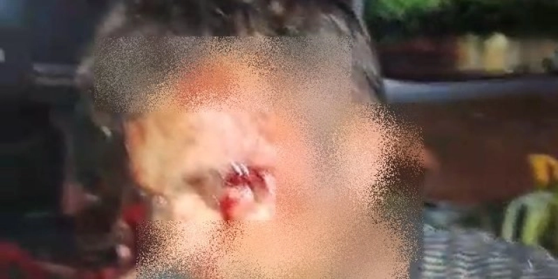 Vendedor de espetinho é agredido com pedrada na Praça da Estação, em Sousa