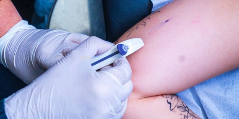 Paraíba vai ofertar contraceptivo subdérmico e capacita médicos e enfermeiros da Atenção Básica A