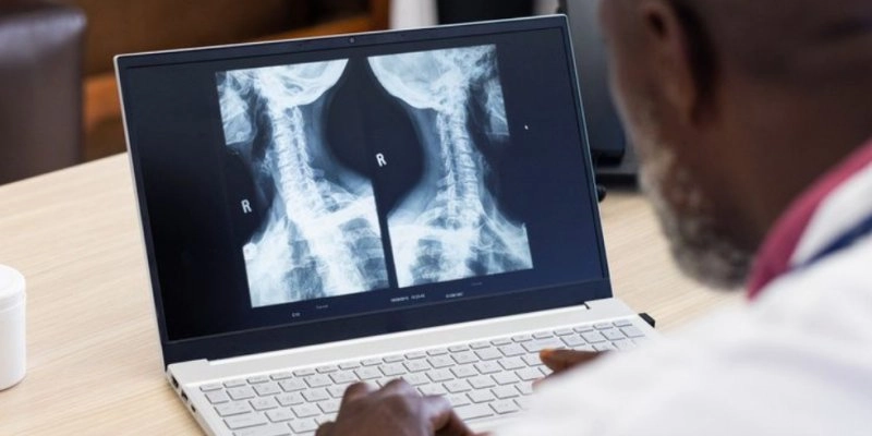Implementada em 2024, telerradiologia em hospitais federais já fez mais de 500 mil exames