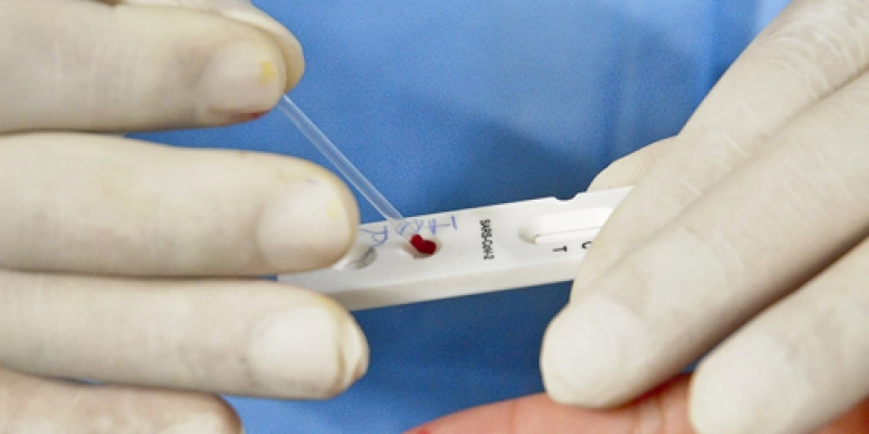 Governo abre chamada pública para aquisição de testes sorológicos para detecção da Covid-19