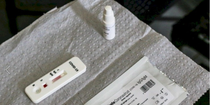 Pesquisadores identificam método capaz de prever gravidade da covid-19