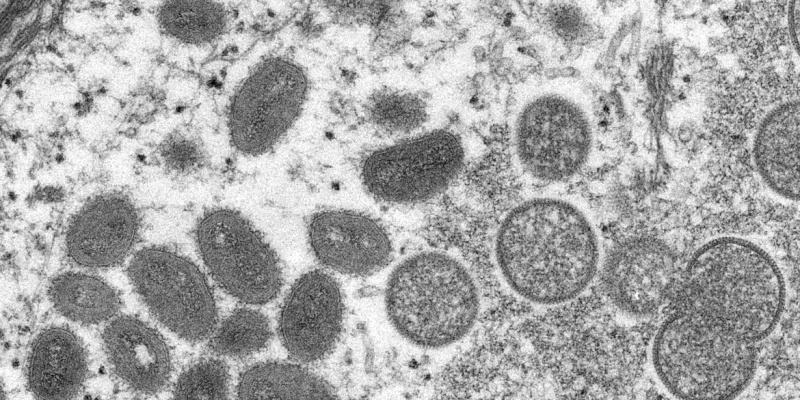 Exames para detecção de monkeypox serão realizados no Lacen-PB