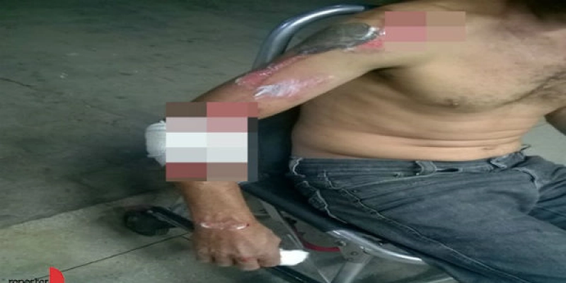 Casal fica ferido, após colidir moto em animal na PB-359, entre São Francisco e Aparecida