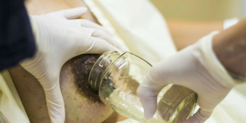 Maternidade do HGM registra aumento de doações de leite humano