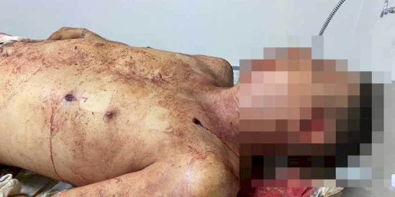Jovem é morto a tiros ao ter casa invadida por elementos armados em São José da Lagoa Tapada