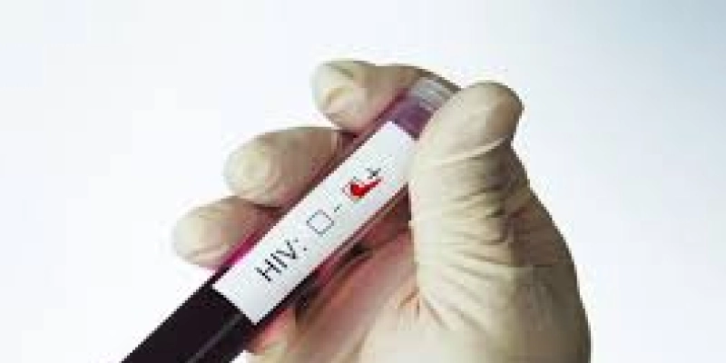 OMS: epidemia de aids não terá fim sem ações direcionadas