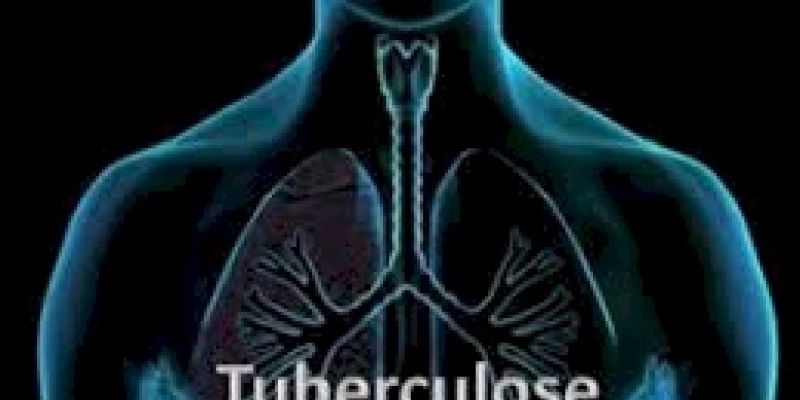 Tuberculose: medicamento para tratamento mais curto está sob consulta