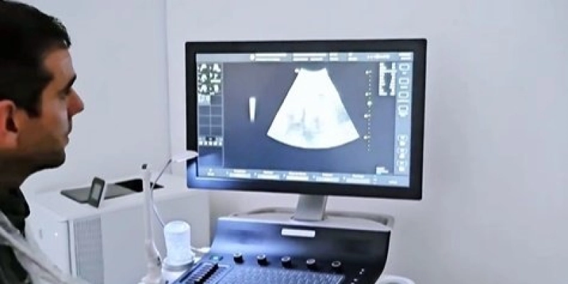Primeiros exames com o novo equipamento de ultrassonografia foram realizados na Policlínica de Aparecida 