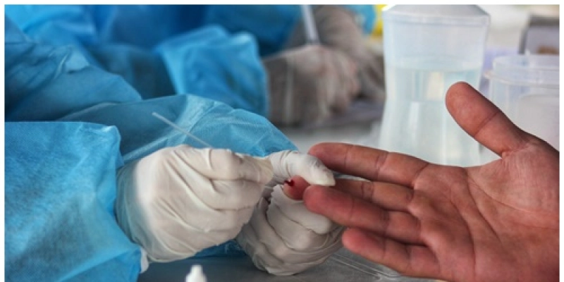 Depen: presídios federais receberam 87 mil testes rápidos de covid-19