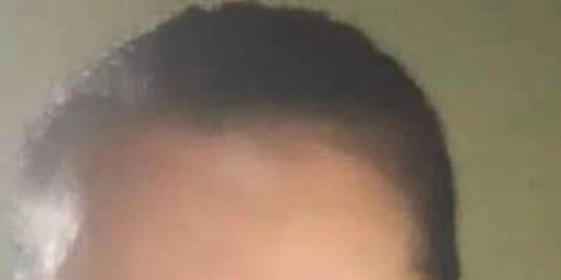 Mulher não resiste e morre em hospital após ser picada por cobra na Paraíba 