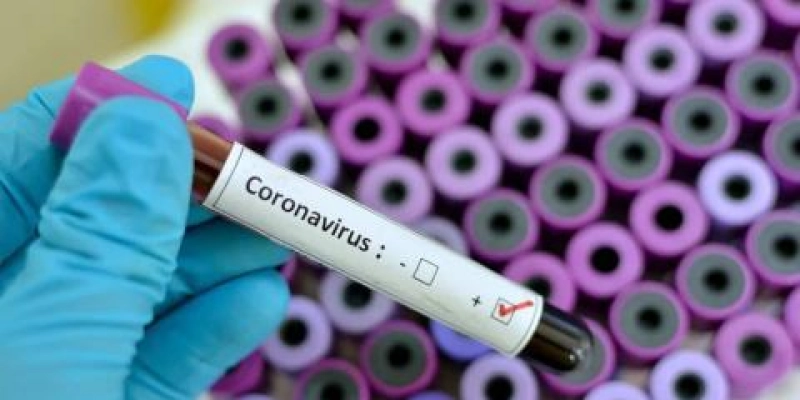 Saúde já distribuiu quase 1 milhão de testes para coronavírus