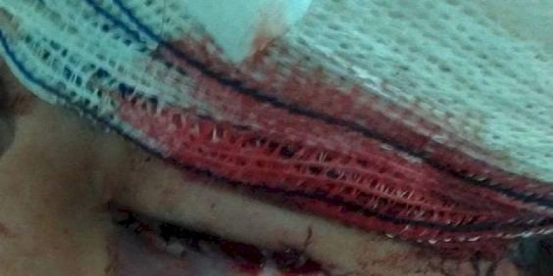 Mulher é brutalmente agredida com barra de ferro na PB; imagem forte