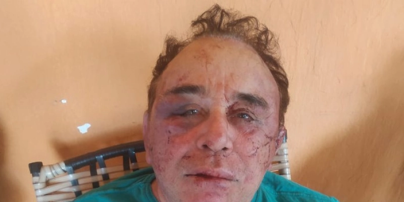 Em Nota, família fala sobre suposta armação no caso da agressão ao prefeito eleito de Santa Terezinha, Arimateia Camboim