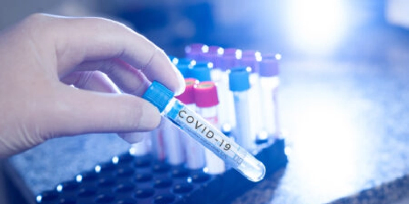 Paraíba amplia oferta de exame laboratorial para Covid-19