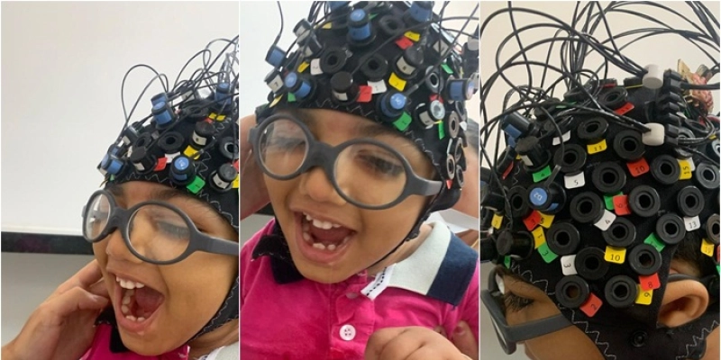 Rede Cuidar participa de pesquisa que identifica estímulo cerebral em crianças com microcefalia