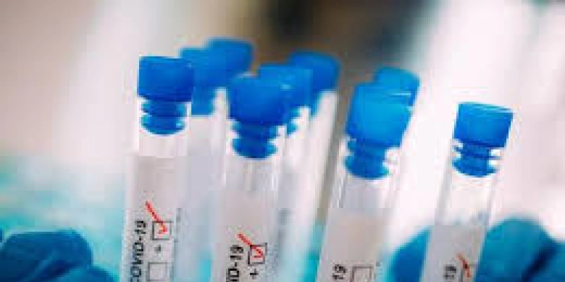 40% dos municípios do país ainda não registram casos de doenças respiratórias ou Covid-19
