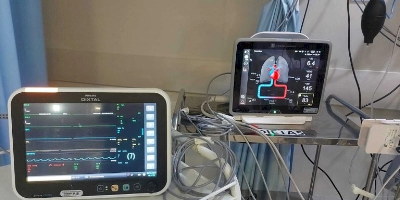 Hospital Metropolitano realiza 3º transplante cardíaco 100% SUS de 2023 com uso de equipamento inédito na Paraíba