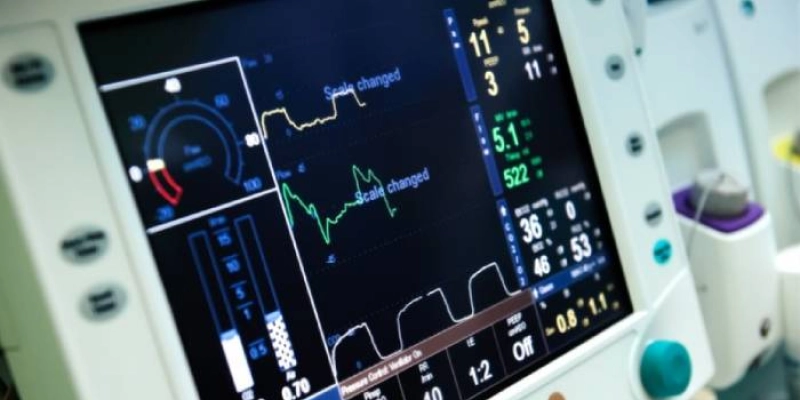 Covid-19: SENAI e indústrias brasileiras vão recuperar 3,6 mil respiradores mecânicos que precisam de manutenção
