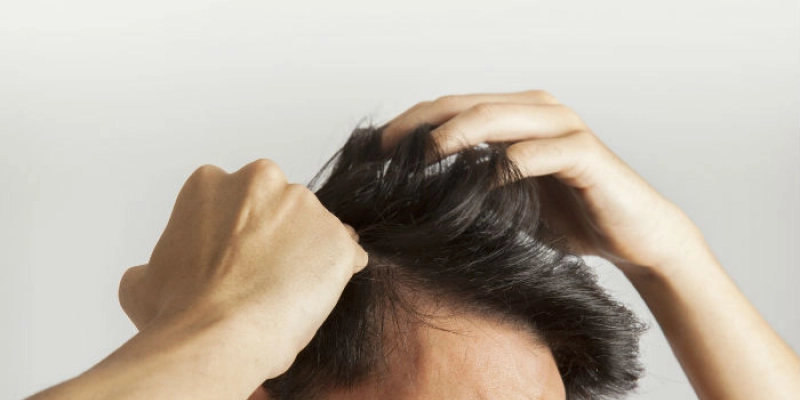 Metade da população masculina pode sofrer com a perda do cabelo até os 50 anos, segundo OMS