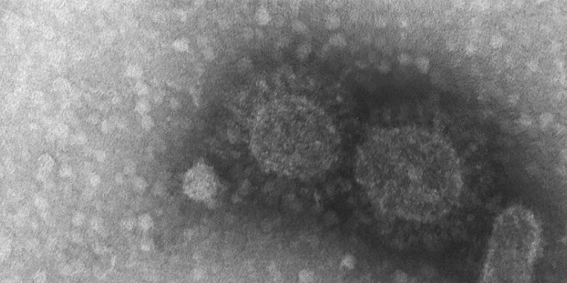 Brasil registra 570 casos de infecção pela variante Delta