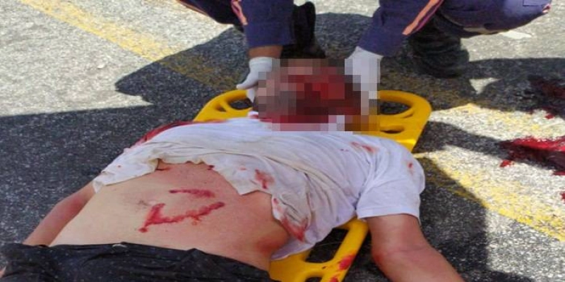 URGENTE - Popular fica gravemente ferido em acidente de carro, entre Sousa e Uiraúna; imagens e vídeo