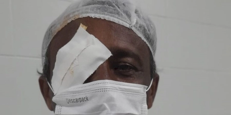 Opera Paraíba realiza mutirão de cirurgia de pterígio no Hospital de Clínicas de Campina Grande
