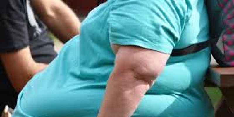 Saúde quer sugestões sobre protocolo para tratamento de obesidade