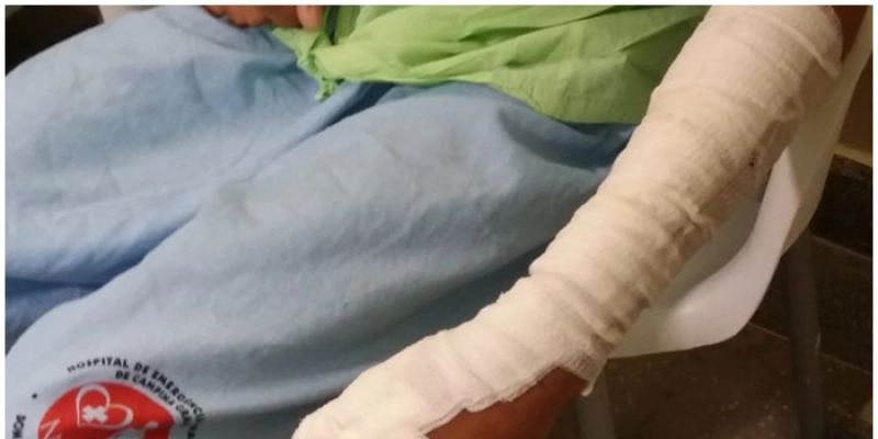 Hospital de Trauma de Campina Grande divulga balanço dos atendimentos da ala de queimados
