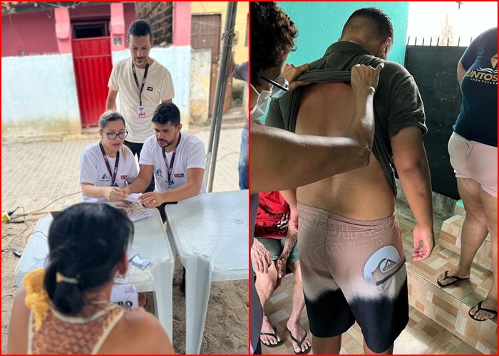 Atividades dedicadas ao mês de combate à hanseníase