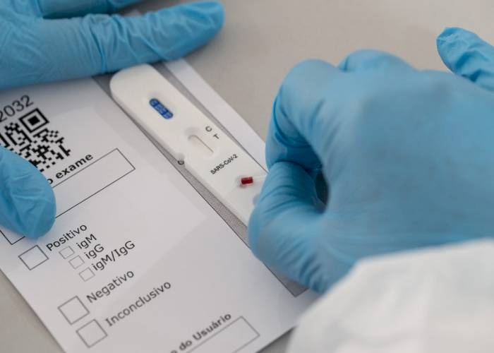 Boletim epidemiologico da Covid-19, no Brasil