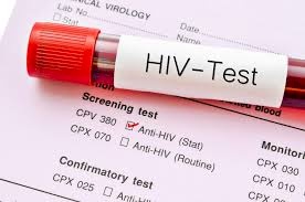 Casos de sífilis e de HIV/aids