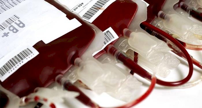Fiocruz se posiciona contra a PEC do Plasma