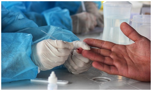 Testes 