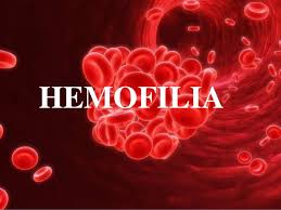 Hemofilia