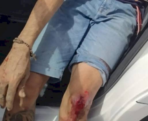 Duas pessoas são alvejadas à bala enquanto andavam de moto na região de Brejo do Cruz