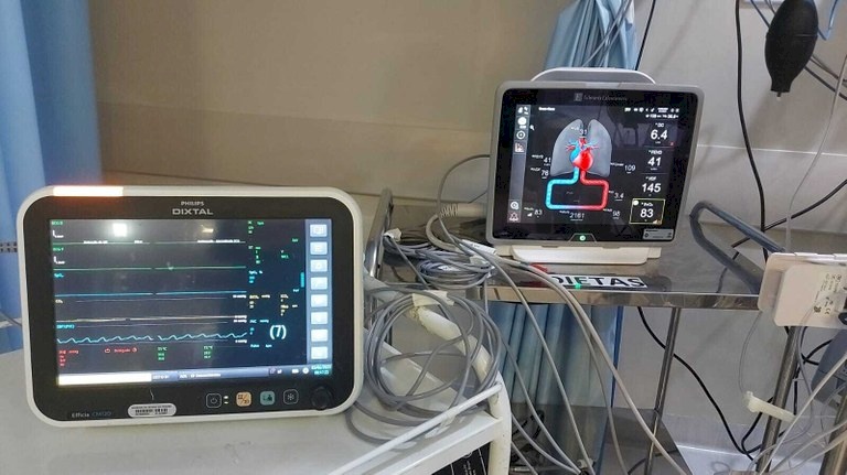 Hospital Metropolitano realiza 3º transplante cardíaco 100% SUS de 2023 com uso de equipamento inédito na Paraíba