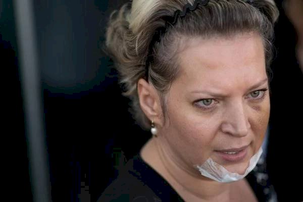 Remédio usado por Joice Hasselmann pode causar perda de memória