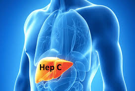 Hepatite C