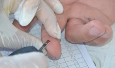 Alerta para riscos da diabetes à visão