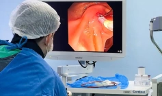 Primeira ressecção endoscópica de tumor precoce de reto