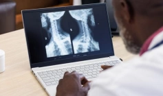 Implementada em 2024, telerradiologia em hospitais federais já fez mais de 500 mil exames
