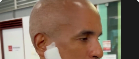 Comandante-geral da PM da Paraíba sofre acidente durante treinamento com motoaquática em Cabedelo