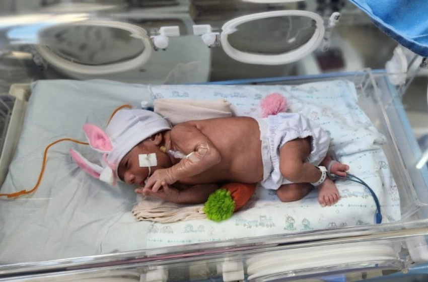 Imagem Hospital Edson Ramalho faz ensaio fotográfico de Páscoa com bebês internados nas unidades de cuidados avançados