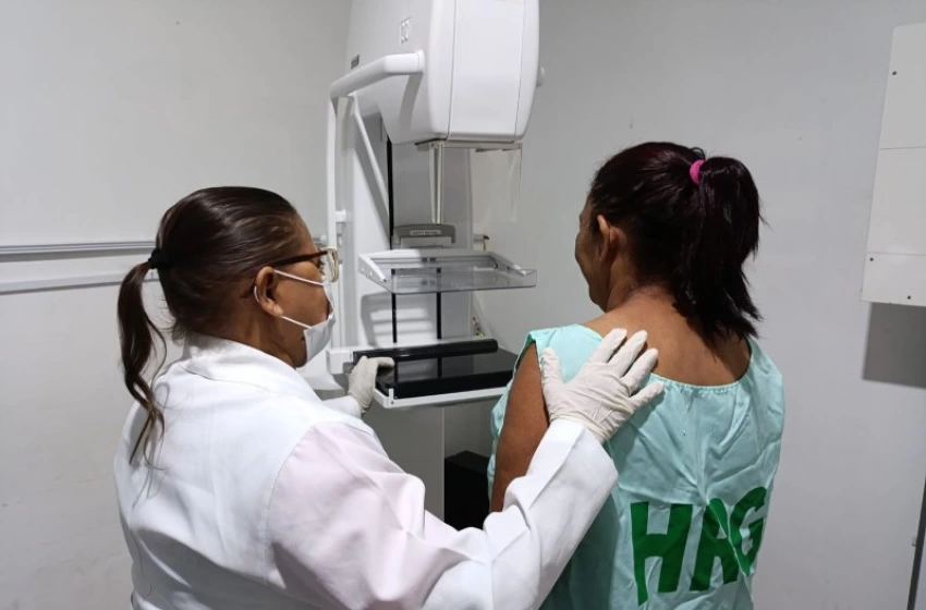 Imagem Imagem de exame de mamografia realizado pelo SUS